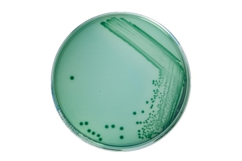Những điều chưa biết về nhóm vi khuẩn Vibrio