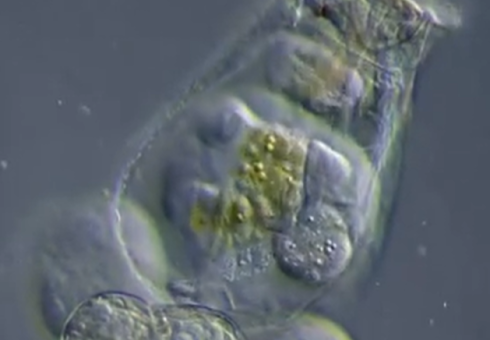 Rotifer đẻ trứng xem qua kính hiển vi