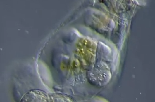 Rotifer đẻ trứng xem qua kính hiển vi